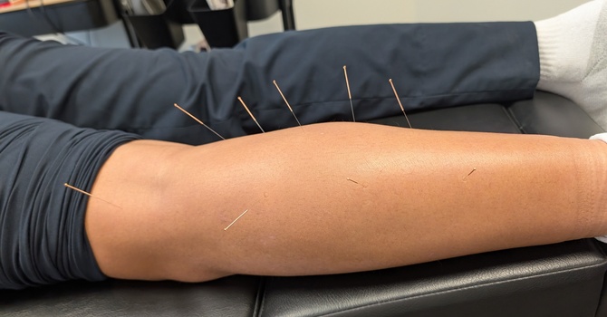 Registered Massage Therapy